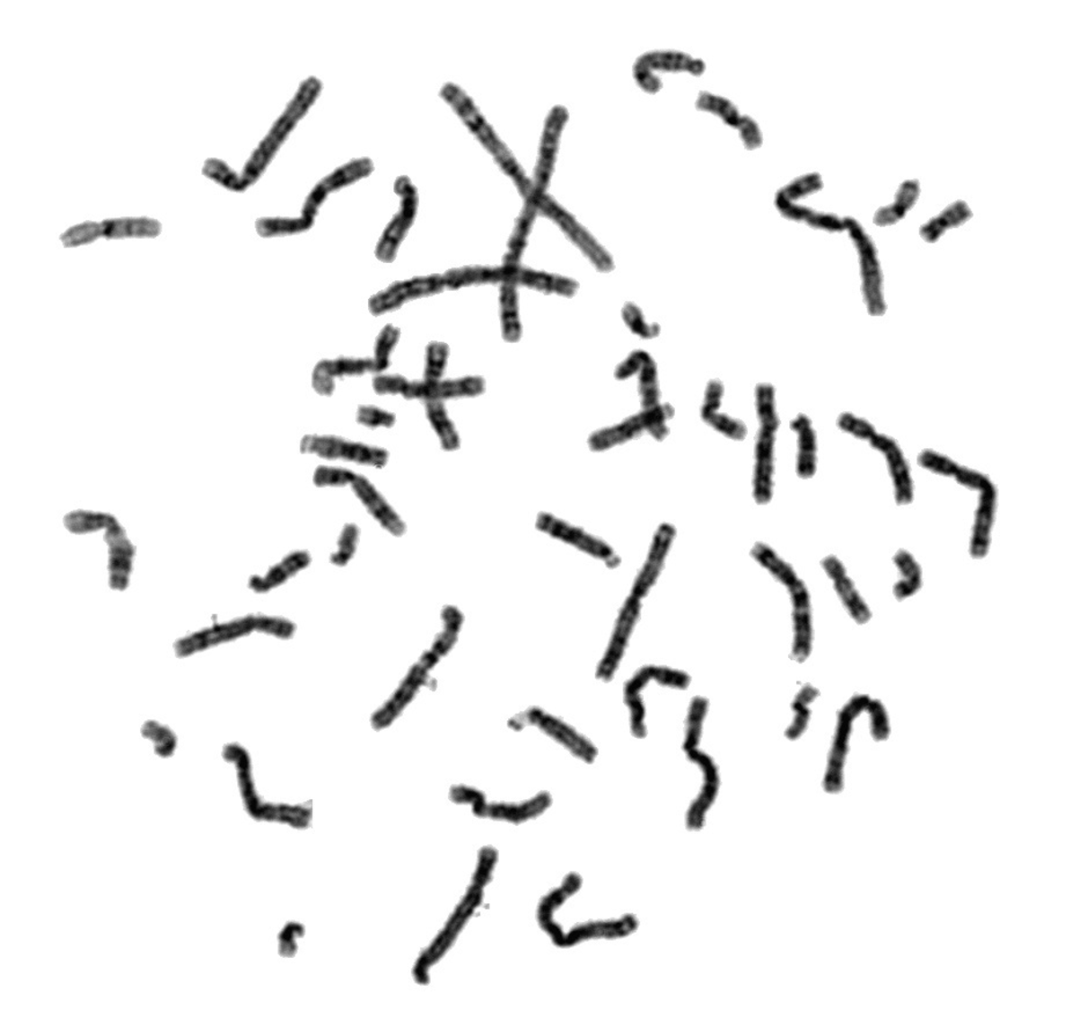 Visualització de cromosomes